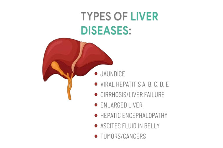 Liver Diseases That You Should Know About, And What Causes Them