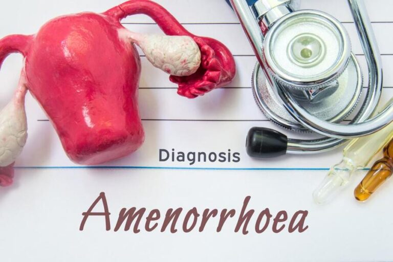 A handy guide to understanding how to treat amenorrhea naturally