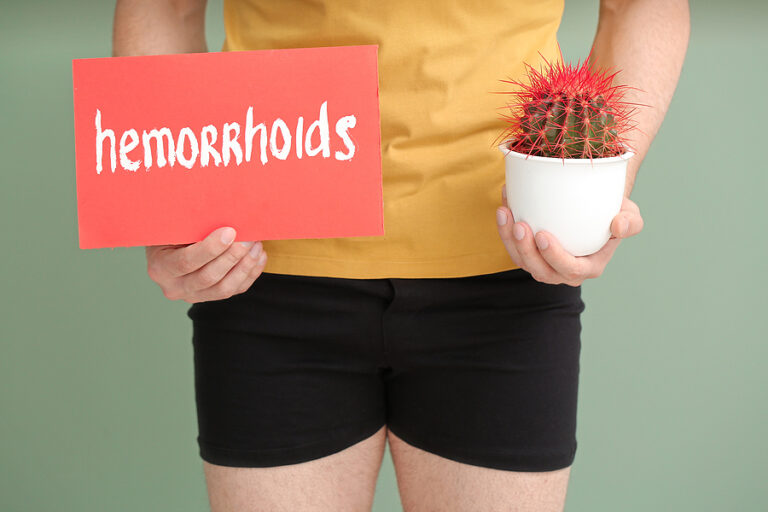 Essential foods to prevent hemorrhoids